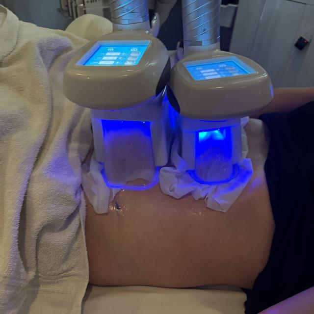 🔥 FAT FREEZE buy 1 get 1 50% off