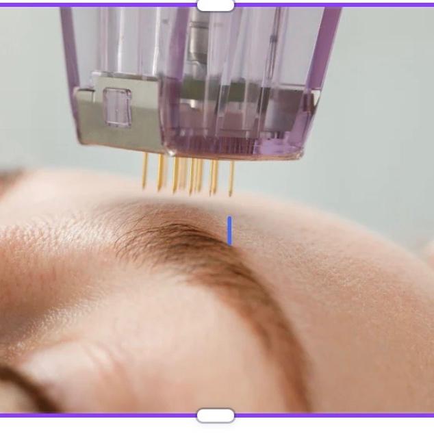 🔥  Skin Glow Trio RF package 