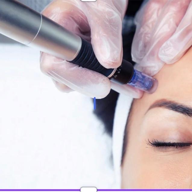 🔥Microneedeling Special 